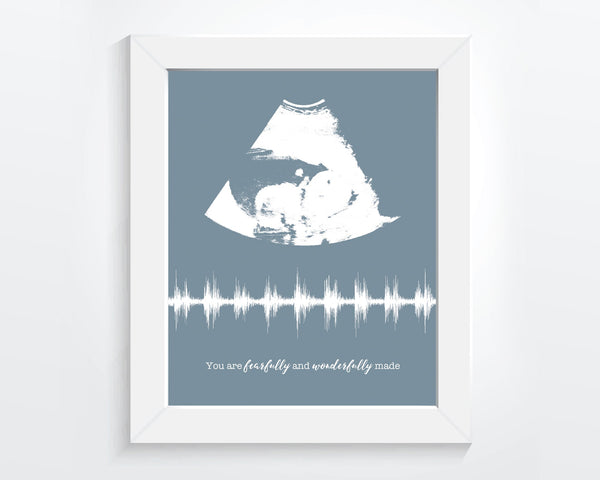 Ultrasound Photo Baby Heartbeat Sound Wave Nursery Art