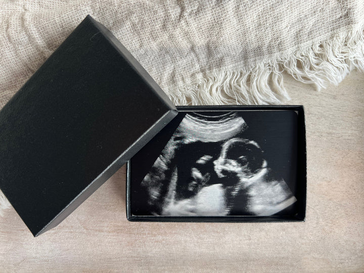 Baby Ultrasound on Metal Wallet Card