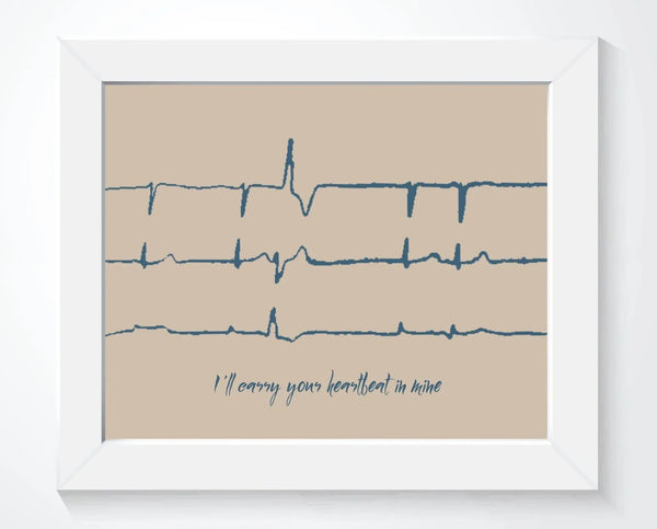 Heartbeat Memorial Gift with Custom EKG Sound Wave Art – Artsy