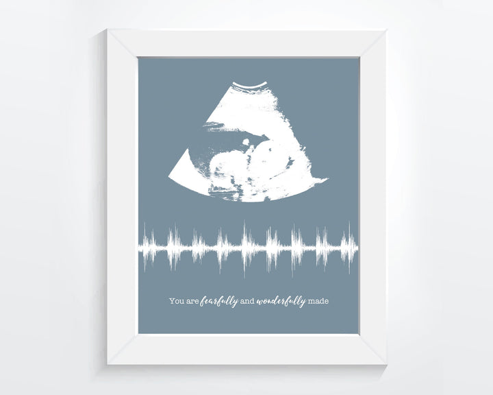 Ultrasound Frame Baby Heartbeat Sound Wave Nursery Wall Art