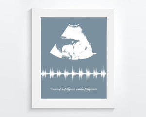 Ultrasound Frame Baby Heartbeat Sound Wave Nursery Wall Art