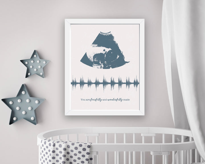 Ultrasound Frame Baby Heartbeat Sound Wave Nursery Wall Art